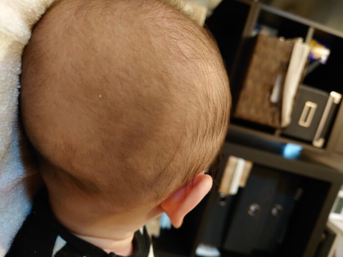 生後2ヶ月の赤ちゃんの後頭部